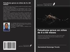 Buchcover von Paludismo grave en niños de 6 a 60 meses