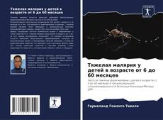 Capa do livro de Тяжелая малярия у детей в возрасте от 6 до 60 месяцев 