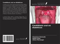 Buchcover von Candidiasis oral en diabéticos