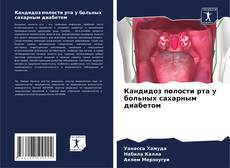 Couverture de Кандидоз полости рта у больных сахарным диабетом