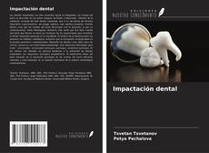 Impactación dental kitap kapağı