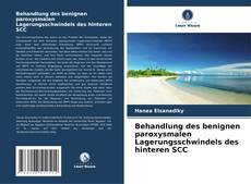 Buchcover von Behandlung des benignen paroxysmalen Lagerungsschwindels des hinteren SCC