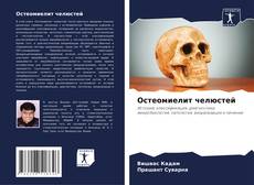 Остеомиелит челюстей的封面