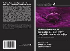 Copertina di Polimorfismo en el promotor del gen mif y riesgo de cáncer de vejiga