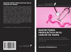 Buchcover von MASTECTOMÍA PROFILÁCTICA EN EL CÁNCER DE MAMA
