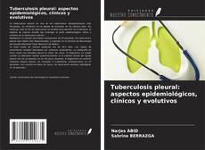 Copertina di Tuberculosis pleural: aspectos epidemiológicos, clínicos y evolutivos