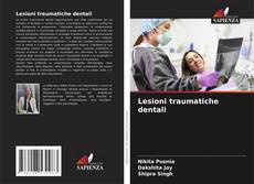 Couverture de Lesioni traumatiche dentali