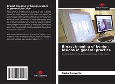 Portada del libro de Breast imaging of benign lesions in general practice