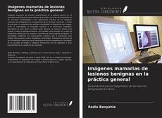 Copertina di Imágenes mamarias de lesiones benignas en la práctica general