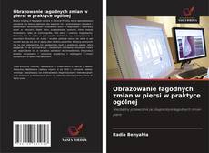 Obrazowanie łagodnych zmian w piersi w praktyce ogólnej kitap kapağı