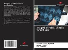 Обложка Imaging cerebral venous thrombosis