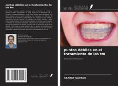 Copertina di puntos débiles en el tratamiento de los tm