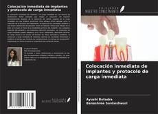 Copertina di Colocación inmediata de implantes y protocolo de carga inmediata