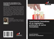 Couverture de Inserimento immediato di un impianto e protocollo di carico immediato