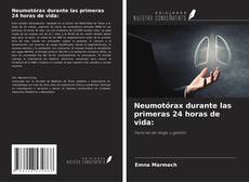 Buchcover von Neumotórax durante las primeras 24 horas de vida: