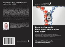 Buchcover von Diagnóstico de la hidatidosis con nuevos kits ELISA