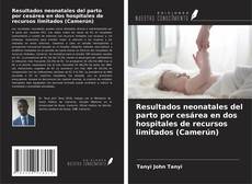 Capa do livro de Resultados neonatales del parto por cesárea en dos hospitales de recursos limitados (Camerún) 