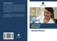 Bookcover of Deckprothesen