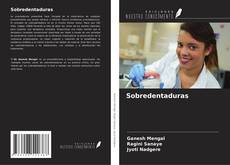 Capa do livro de Sobredentaduras 