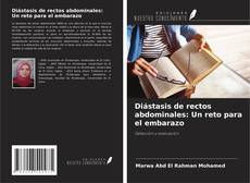 Buchcover von Diástasis de rectos abdominales: Un reto para el embarazo