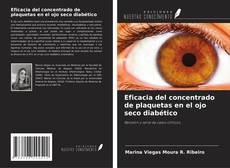 Couverture de Eficacia del concentrado de plaquetas en el ojo seco diabético