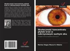 Bookcover of Skuteczność koncentratu płytek krwi w cukrzycowym suchym oku