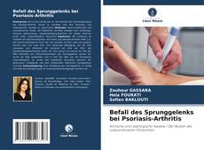 Couverture de Befall des Sprunggelenks bei Psoriasis-Arthritis