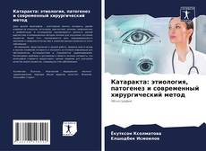 Bookcover of Катаракта: этиология, патогенез и современный хирургический метод