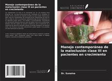 Buchcover von Manejo contemporáneo de la maloclusión clase III en pacientes en crecimiento