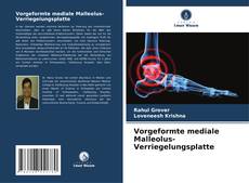 Buchcover von Vorgeformte mediale Malleolus-Verriegelungsplatte