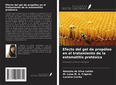 Buchcover von Efecto del gel de propóleo en el tratamiento de la estomatitis protésica