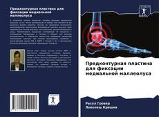 Обложка Предконтурная пластина для фиксации медиальной маллеолуса