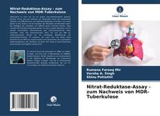 Couverture de Nitrat-Reduktase-Assay - zum Nachweis von MDR-Tuberkulose