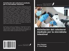 Buchcover von Asimilación del colesterol mediada por la microbiota intestinal