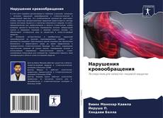 Portada del libro de Нарушения кровообращения