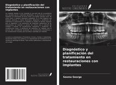 Couverture de Diagnóstico y planificación del tratamiento en restauraciones con implantes