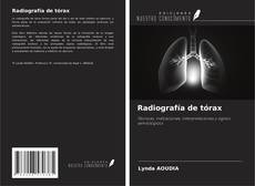 Buchcover von Radiografía de tórax