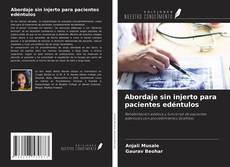 Buchcover von Abordaje sin injerto para pacientes edéntulos