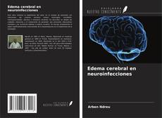 Buchcover von Edema cerebral en neuroinfecciones