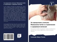 Обложка За пределами хлопьев: Malassezia furfur и стремление к здоровым волосам