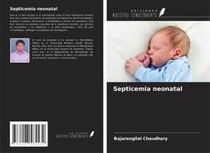 Buchcover von Septicemia neonatal