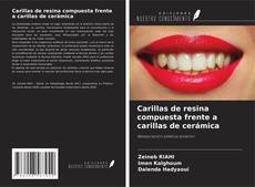 Buchcover von Carillas de resina compuesta frente a carillas de cerámica