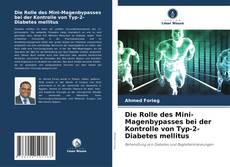 Couverture de Die Rolle des Mini-Magenbypasses bei der Kontrolle von Typ-2-Diabetes mellitus