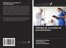 Buchcover von Utilidad de la prueba de procalcitonina