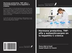 Buchcover von Hormona prolactina, TNF-alfa y autoanticuerpos en la hepatitis C crónica