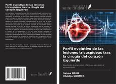 Buchcover von Perfil evolutivo de las lesiones tricuspídeas tras la cirugía del corazón izquierdo