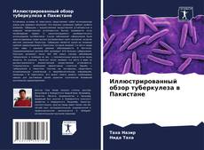 Couverture de Иллюстрированный обзор туберкулеза в Пакистане