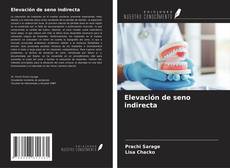Buchcover von Elevación de seno indirecta
