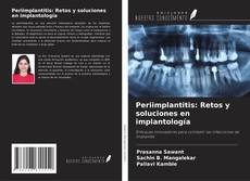 Buchcover von Periimplantitis: Retos y soluciones en implantología