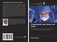 Copertina di Tratamiento del cáncer de recto